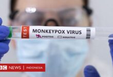 World health organization says monkeypox is not a global health emergency right now