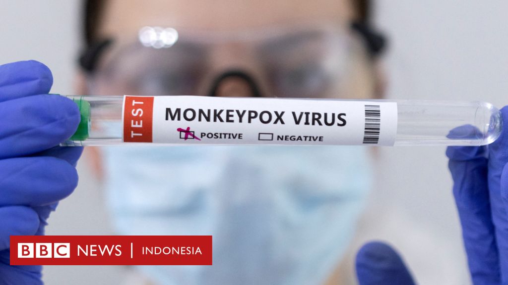 World health organization says monkeypox is not a global health emergency right now