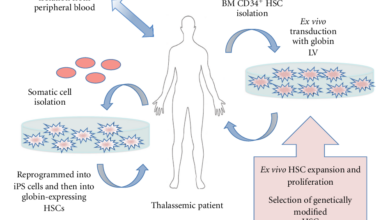 Gene therapy trial shows early success in people with haemophilia b