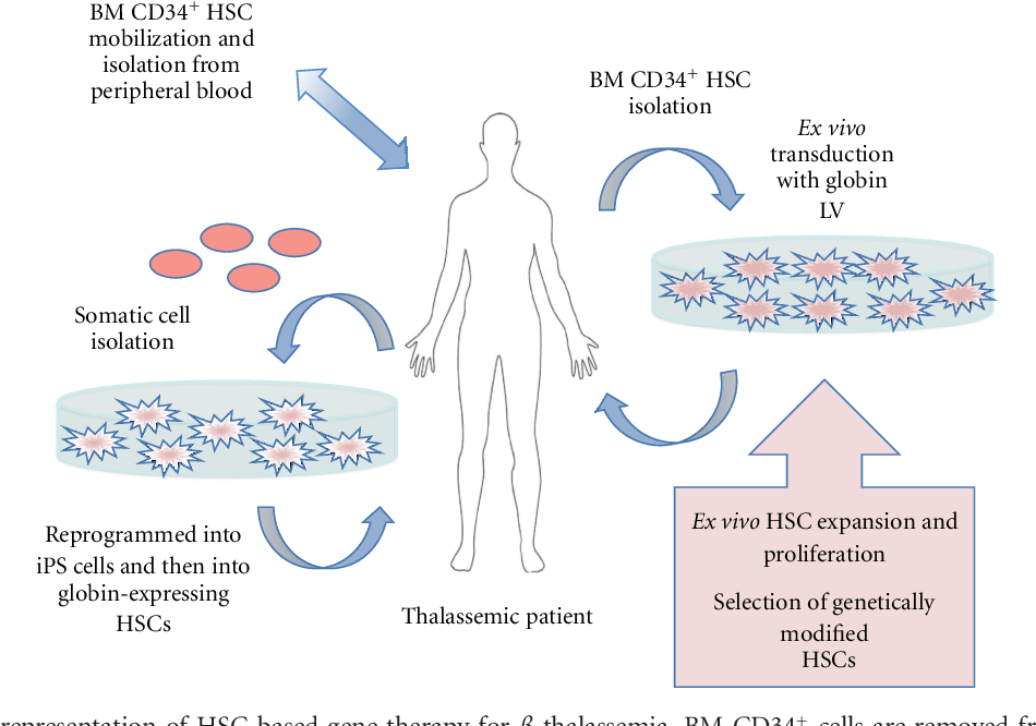 Gene therapy trial shows early success in people with haemophilia b