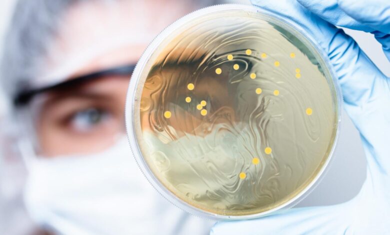 Largest bacterium ever discovered has unexpectedly complex cells