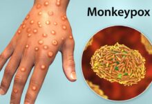 There is an effective treatment for monkeypox but its hard to get