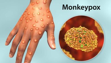 There is an effective treatment for monkeypox but its hard to get