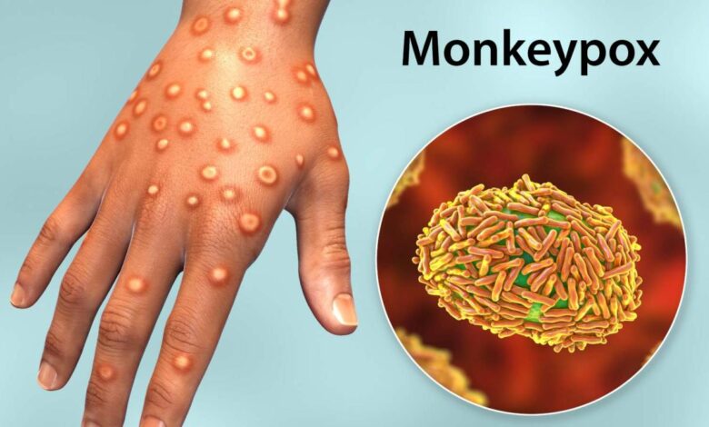 There is an effective treatment for monkeypox but its hard to get