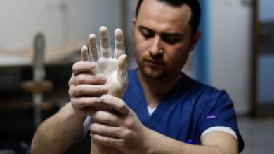 Thousands of gaza amputees to get rapid prosthetic limbs using uk tech