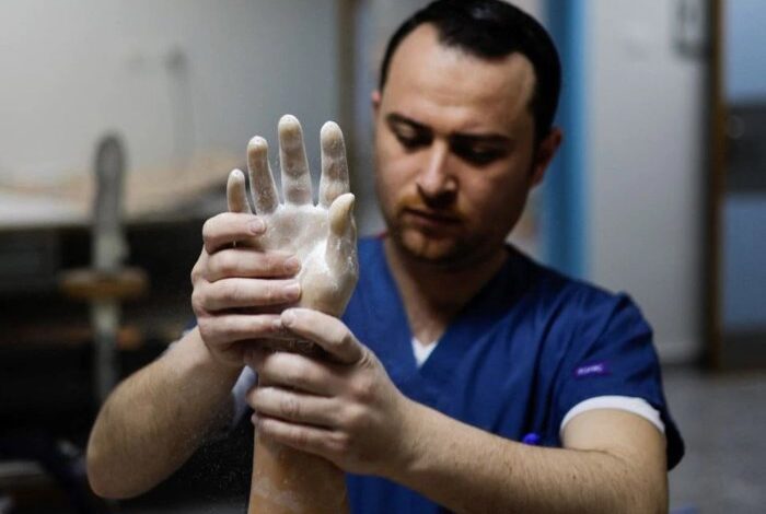 Thousands of gaza amputees to get rapid prosthetic limbs using uk tech