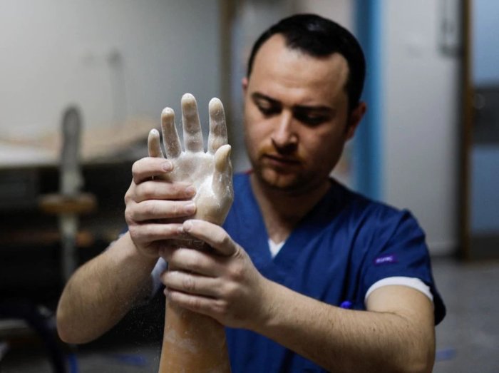 Thousands of gaza amputees to get rapid prosthetic limbs using uk tech