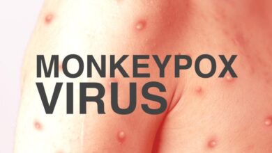 Monkeypox symptoms outbreak