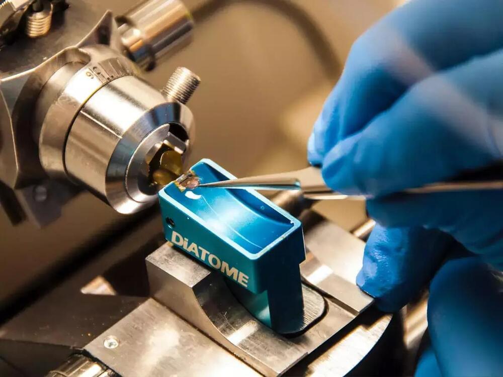 Human translational beyondbordersnews